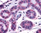 FAK / Focal Adhesion Kinase Antibody (C-Terminus)